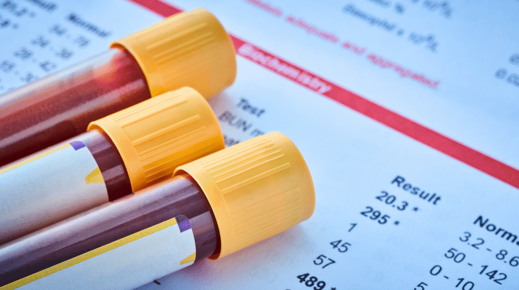 Blutproben und Laborbefund zur Bestimmung von Eisenstatus und Eisenmangel