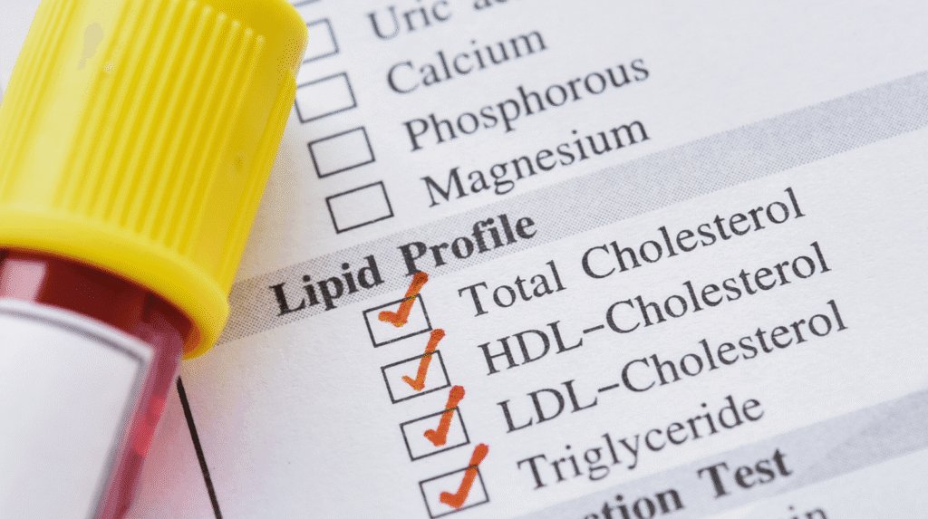 Lipidprofil mit Cholesterinwerten auf einem Laborformular
