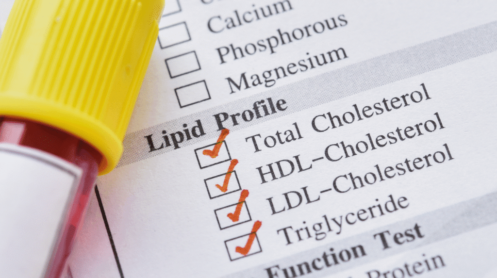 Cholesterin ab 40: Lipidprofil im Laborbericht mit Gesamtcholesterin, HDL, LDL und Triglyceriden
